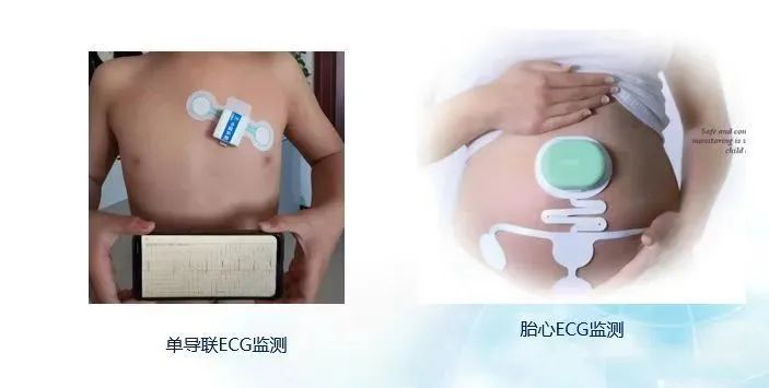 ecg上海为什么不能用科技战“疫”，中以（上海）创新园推进AI+医疗创新发展_https://www.jmylbn.com_新闻资讯_第2张